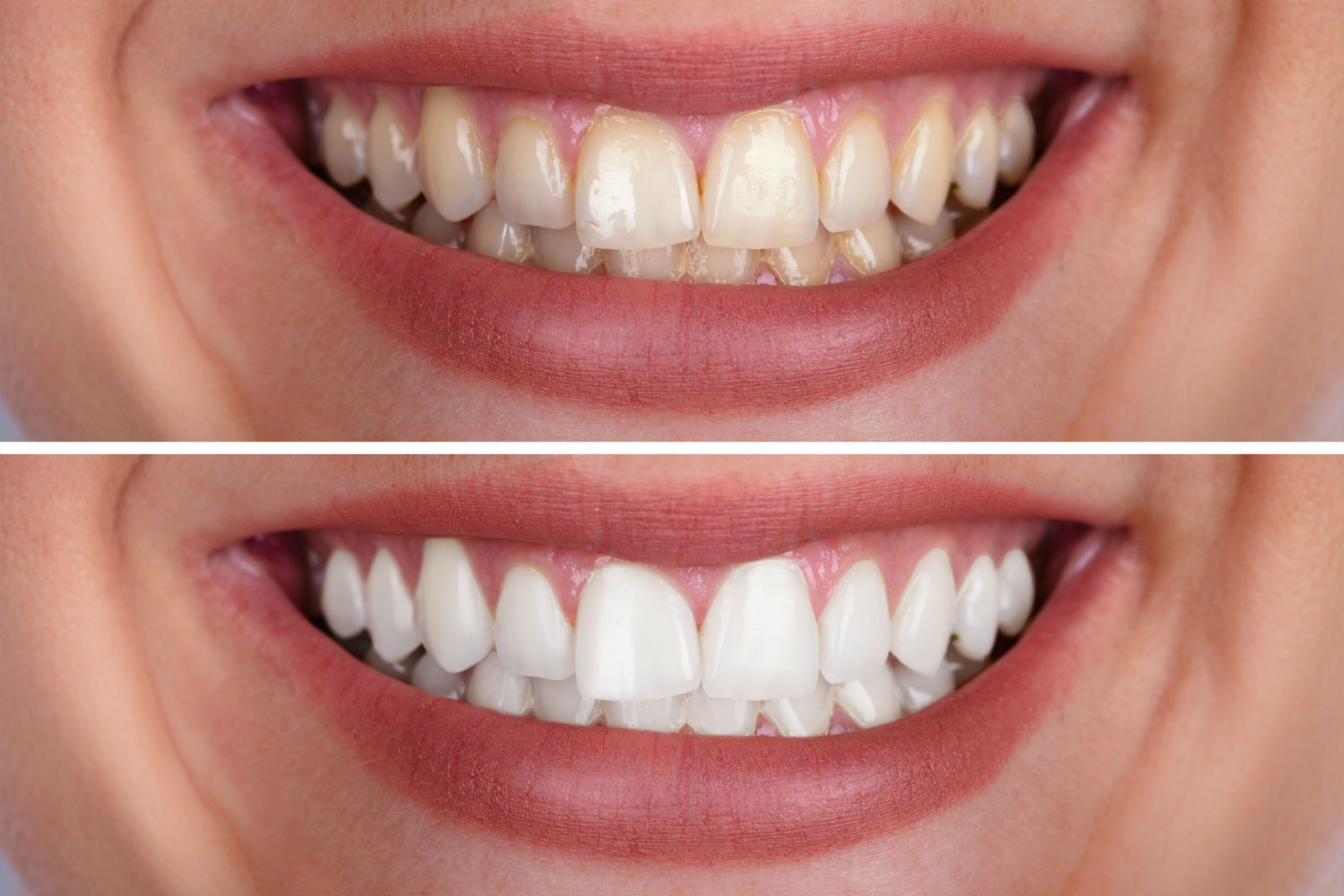 Blog Dodds Dental